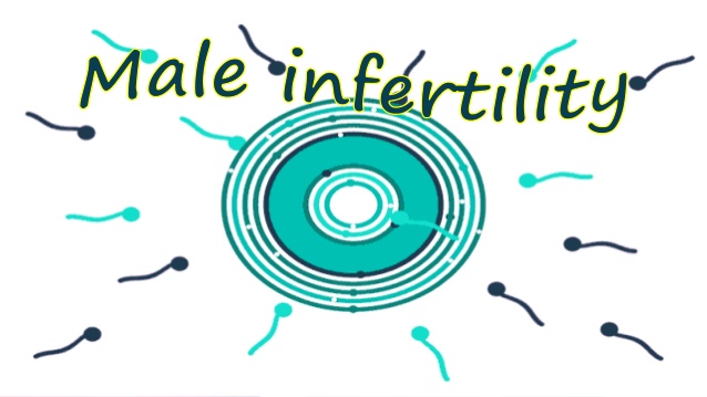 Y-Chromosomal Deletions − a Risk Factor for Male Infertility.